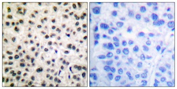 MEF-2 (phospho-Ser408) antibody