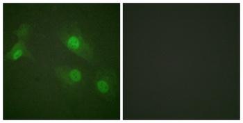 NF kappa B-p105 (phospho-Ser927) antibody