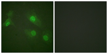 NFκB-p105 (phospho Ser927) rabbit pAb
