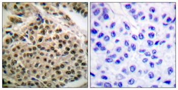 NFκB-p105 (phospho Ser927) rabbit pAb