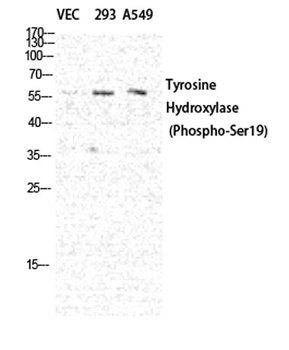 TH (phospho-Ser19) antibody