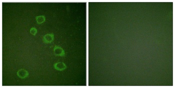 Neu (phospho-Tyr1221/Y1222) antibody