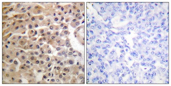 Neu (phospho-Tyr1221/Y1222) antibody