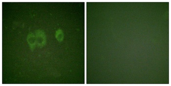 IGF-IR (phospho-Tyr1161) antibody