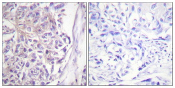 Cot (phospho Thr290) rabbit pAb