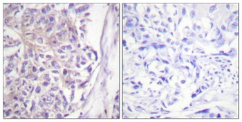 Cot (phospho-Thr290) antibody