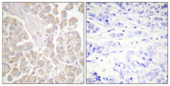 Crk-L (phospho-Tyr207) antibody