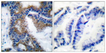 Crk-L (phospho-Tyr207) antibody