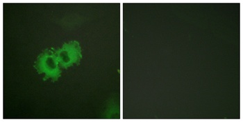 Caldesmon (phospho Ser789) rabbit pAb