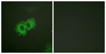 Caldesmon (phospho-Ser789) antibody