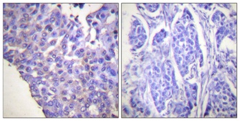Caldesmon (phospho Ser789) rabbit pAb