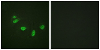 Ets-1 (phospho Thr38) rabbit pAb