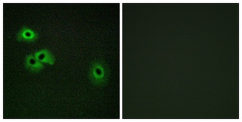 Calmodulin (phospho Thr80/S82) rabbit pAb
