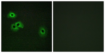 Calmodulin (phospho-Thr80/S82) antibody