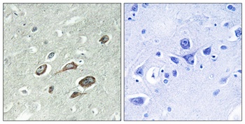 Calmodulin (phospho Thr80/S82) rabbit pAb