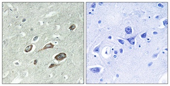 Calmodulin (phospho-Thr80/S82) antibody