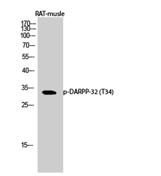 DARPP-32 (phospho-Thr34) antibody