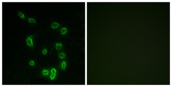 DARPP-32 (phospho-Thr34) antibody