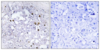 HNF4-α (phospho Ser313) rabbit pAb