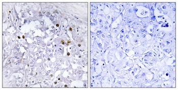 HNF4-alpha (phospho-Ser313) antibody