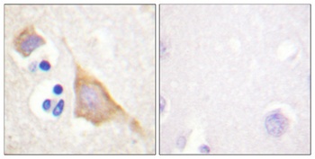 MOR-1 (phospho Ser375) rabbit pAb
