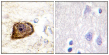 PDGFR-β (phospho Tyr1021) rabbit pAb