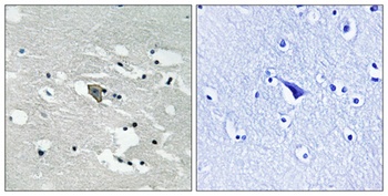 Flt-1 (phospho Tyr1048) rabbit pAb