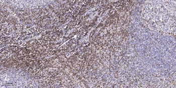 Synuclein-alpha (phospho-Tyr125) antibody