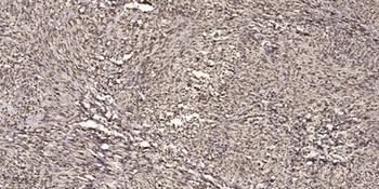 14-3-3 ε rabbit pAb