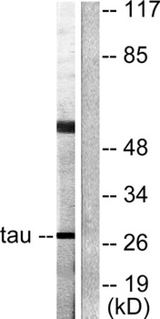 14-3-3 θ/τ rabbit pAb