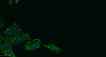 17β-HSD11 rabbit pAb