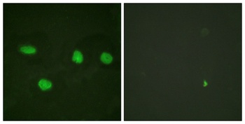 53BP1 antibody