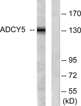 A Cyclase V/VI antibody