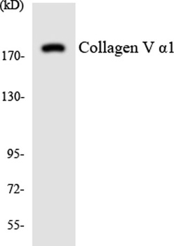 A Cyclase V/VI antibody