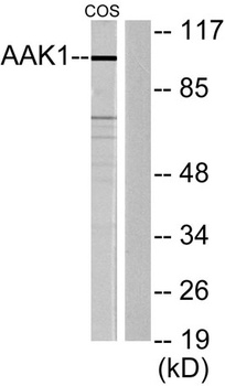 AAK1 antibody