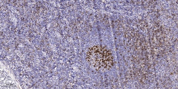 AAK1 antibody