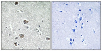 AASD-PPT rabbit pAb