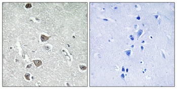 AASD-PPT antibody