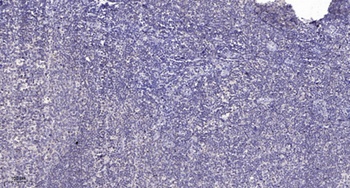 ABCB10 rabbit pAb