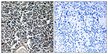 ABCB7 antibody