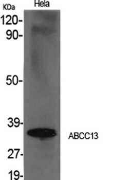 ABCC13 rabbit pAb Antibody