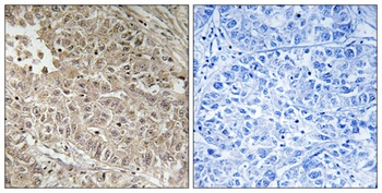 ABCC13 rabbit pAb Antibody