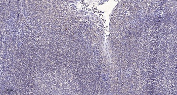 ABCD4 antibody