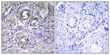 ABHD12 antibody