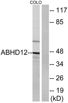 ABHD12 rabbit pAb