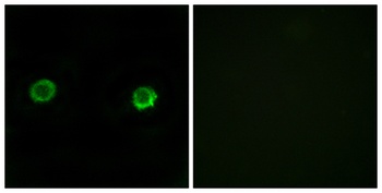 ABHD2 antibody