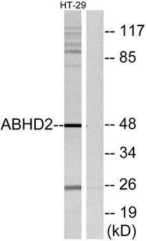 ABHD2 rabbit pAb