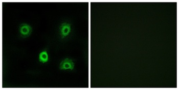 ABHD6 antibody