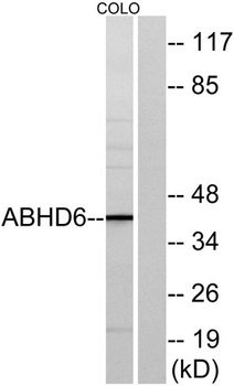 ABHD6 rabbit pAb
