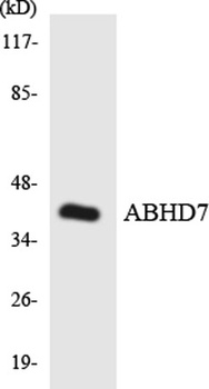 ABHD7 rabbit pAb